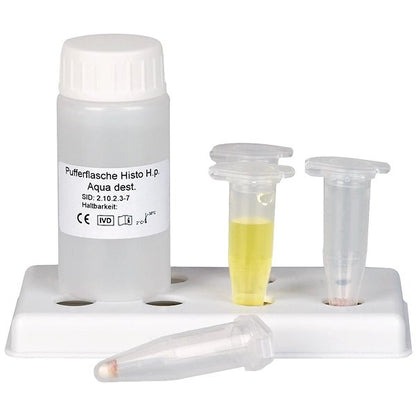 Histo più chiaro H.p. Test dell'Helicobacter Pylori