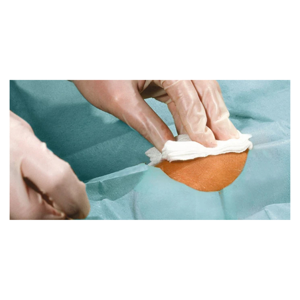 Un primo piano di mani guantate che puliscono una piccola area di pelle con un panno bianco, circondata da teli Hartmann Foliodrape® Protect Lochtücher, autoadesivi, sterili, confezionati singolarmente, della Paul Hartmann AG.